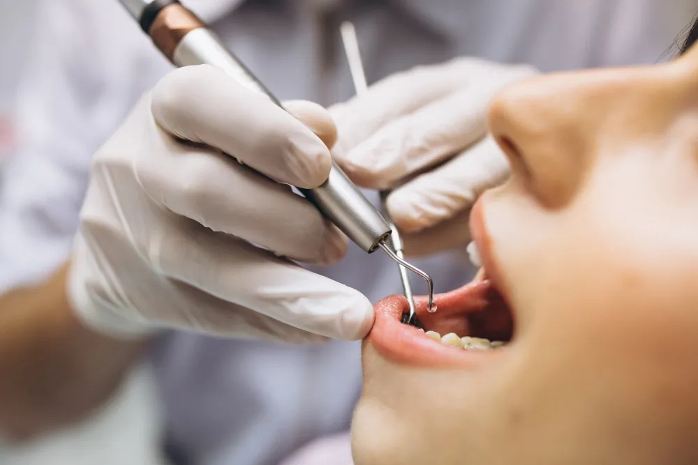 Periodoncia