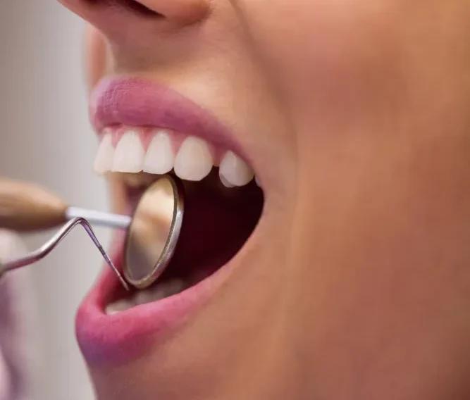 Endodoncia