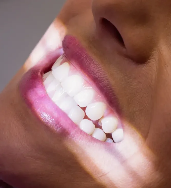 Estética dental