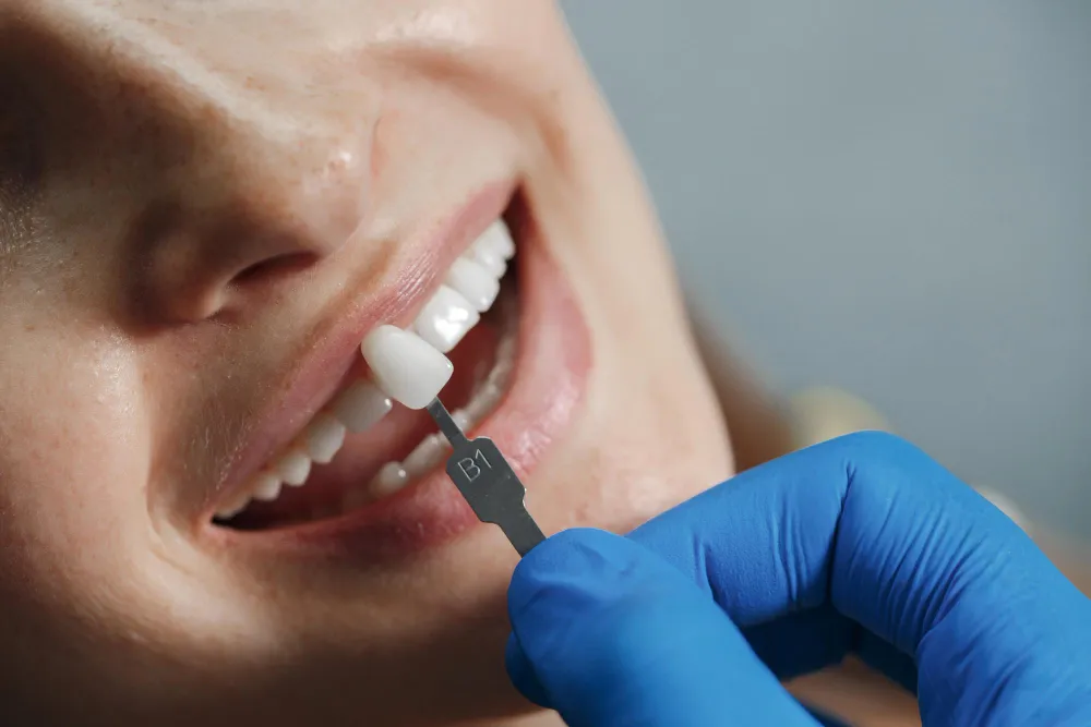 Implantes de carga inmediata